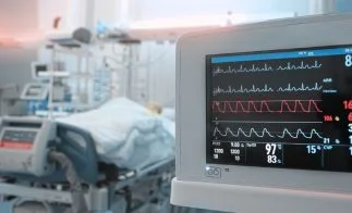 Holter ECG monitoring