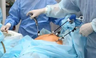 Advance Laparoscopy Surgery 